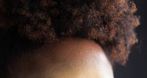 Krása zevnitř ven: Jak strava ovlivňuje vaši pleť a vzhled